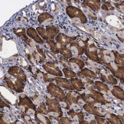 Immunohistochemistry-Paraffin: CRELD2 Antibody [NBP1-81229]