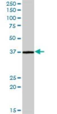 Western Blot: CRELD2 Antibody [H00079174-B01P]