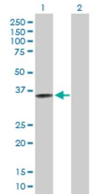 Western Blot: CRELD2 Antibody [H00079174-B01P]