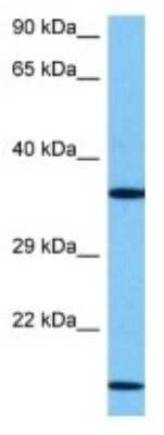 Western Blot: CRELD2 Antibody [NBP3-10820]