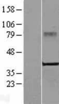 Western Blot: CRELD2 Overexpression Lysate [NBL1-09470]