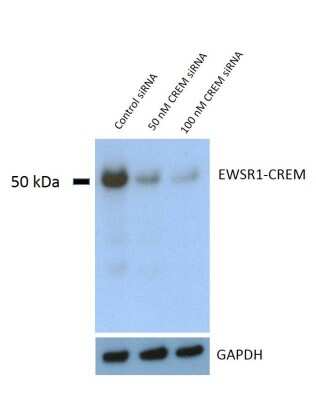 Knockdown Validated: CREM Antibody (3B5) [H00001390-M02]