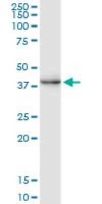 Western Blot: CREM Antibody (3B5) [H00001390-M02]