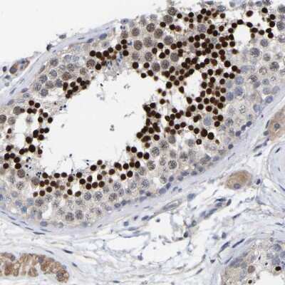 Immunohistochemistry-Paraffin: CREM Antibody [NBP1-81760]