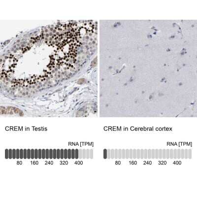 Immunohistochemistry-Paraffin: CREM Antibody [NBP1-81760]