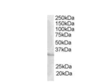 Western Blot: CREM Antibody [NB100-1470]