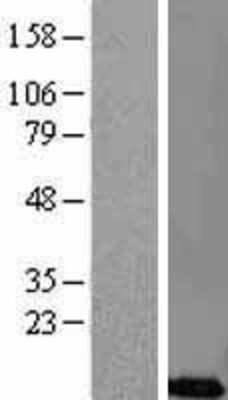 Western Blot: CREM Overexpression Lysate [NBL1-09471]