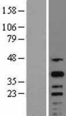 Western Blot: CREM Overexpression Lysate [NBL1-09472]