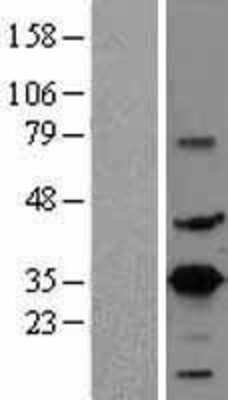 Western Blot: CREM Overexpression Lysate [NBL1-09473]