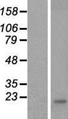 Western Blot: CREM Overexpression Lysate [NBP2-10058]