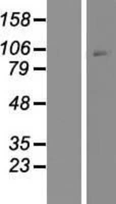 Western Blot: CRHR1/CRF1 Overexpression Lysate [NBP2-10581]