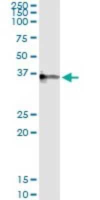 Immunoprecipitation: CRHBP Antibody (3D9) [H00001393-M01]