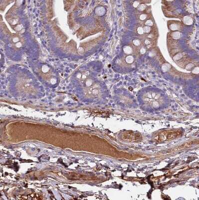 Immunohistochemistry: CRHBP Antibody [NBP1-91811]