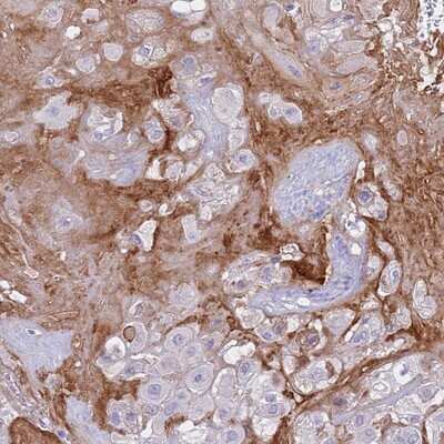 Immunohistochemistry-Paraffin: CRHBP Antibody [NBP1-91811]