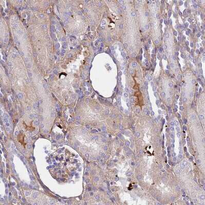 Immunohistochemistry-Paraffin: CRHBP Antibody [NBP1-91811]