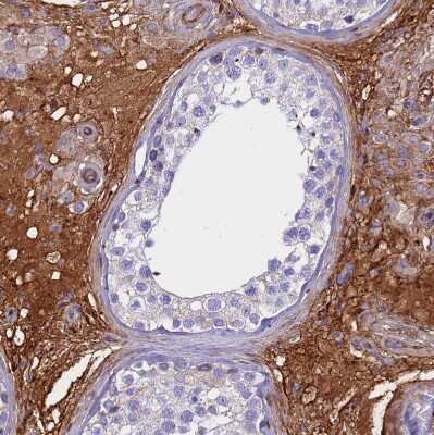 Immunohistochemistry-Paraffin: CRHBP Antibody [NBP1-91811]