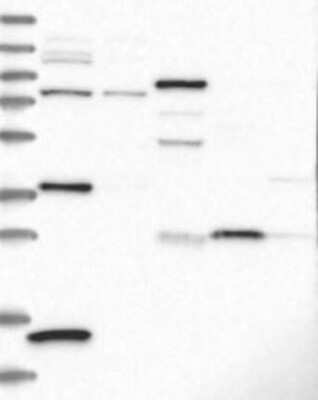 Western Blot: CRHBP Antibody [NBP3-17697]