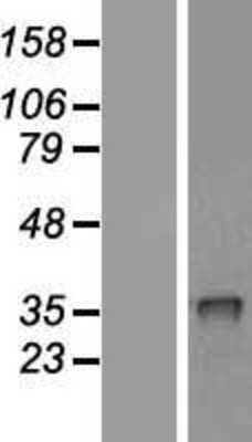 Western Blot: CRHBP Overexpression Lysate [NBL1-09476]