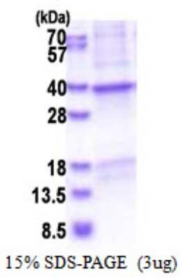 SDS-PAGE: Recombinant Human CRHBP His Protein [NBP2-51572]