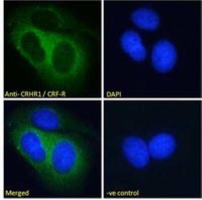 Immunocytochemistry/ Immunofluorescence: CRHR1/CRF1 Antibody [NB100-57078]