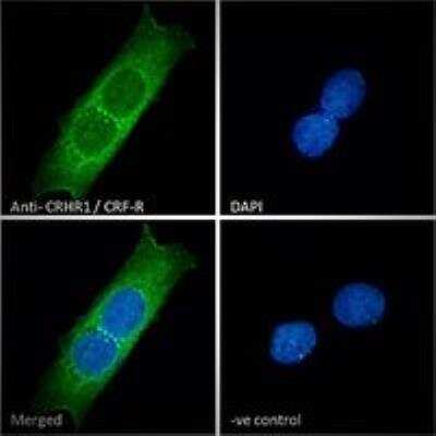 Immunocytochemistry/ Immunofluorescence: CRHR1/CRF1 Antibody [NBP1-00175]