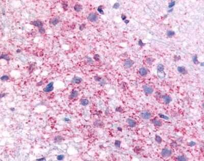 Immunohistochemistry-Paraffin: CRHR1/CRF1 Antibody - BSA Free [NLS1778]