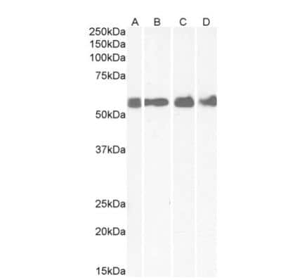 Western Blot: CRHR1/CRF1 Antibody [NBP1-00175]