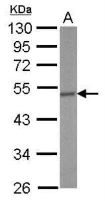 Western Blot: CRHR1/CRF1 Antibody [NBP2-16010]