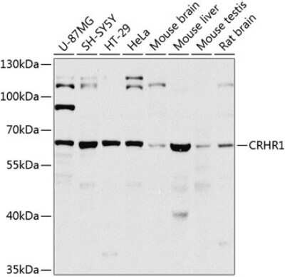 Western Blot: CRHR1/CRF1 AntibodyBSA Free [NBP3-05630]