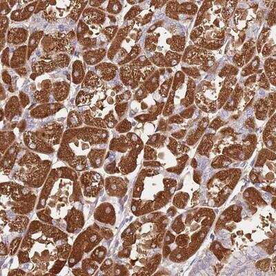 Immunohistochemistry-Paraffin: CRHR2/CRF2 Antibody [NBP2-13875]