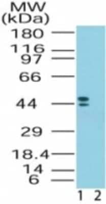 Western Blot: CRHR2/CRF2 Antibody [NB100-56485]