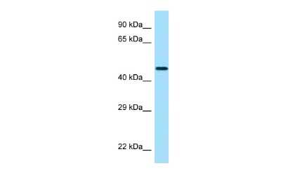 Western Blot: CRHR2/CRF2 Antibody [NBP2-84723]