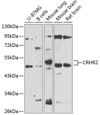 Western Blot: CRHR2/CRF2 AntibodyBSA Free [NBP2-92078]