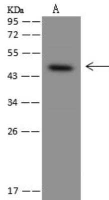 Western Blot: CRHR2/CRF2 Antibody [NBP3-12627]