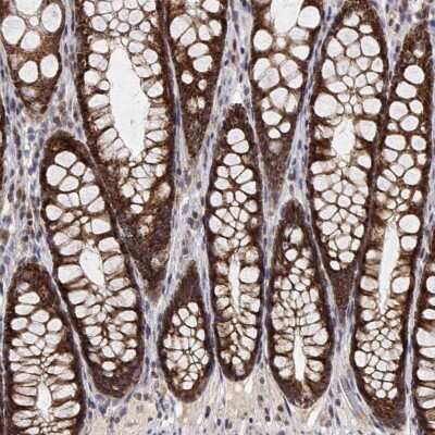 Immunohistochemistry: CRIF1 Antibody [NBP2-39045]