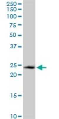 Western Blot: CRIF1 Antibody [H00090480-B01P]