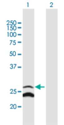 Western Blot: CRIF1 Antibody [H00090480-B01P]