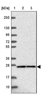 Western Blot: CRIF1 Antibody [NBP2-39045]