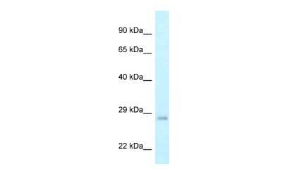 Western Blot: CRIF1 Antibody [NBP2-87211]