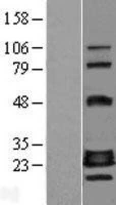 Western Blot: CRIF1 Overexpression Lysate [NBL1-10936]