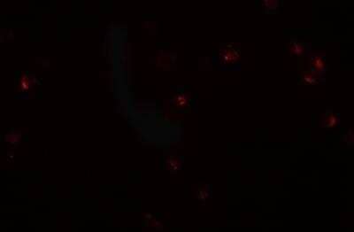 Immunocytochemistry/ Immunofluorescence: CRIM1 Antibody - BSA Free [NBP2-81803]