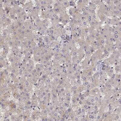 Immunohistochemistry-Paraffin: CRIM1 Antibody [NBP1-80799]