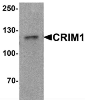 Western Blot: CRIM1 AntibodyBSA Free [NBP2-81803]