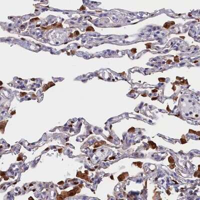 Immunohistochemistry-Paraffin: CRIP1 Antibody [NBP1-84380]