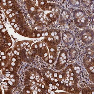 Immunohistochemistry-Paraffin: CRIP1 Antibody [NBP1-84380]