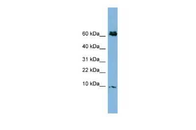 Western Blot: CRIP1 Antibody [NBP2-82758]