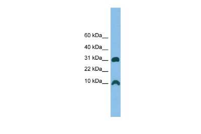 Western Blot: CRIP1 Antibody [NBP2-82771]