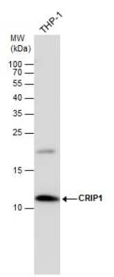 Western Blot: CRIP1 Antibody [NBP3-13002]