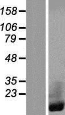 Western Blot: CRIP1 Overexpression Lysate [NBP2-08218]