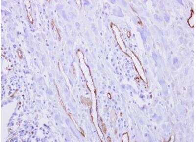 Immunohistochemistry-Paraffin: CRIP2 Antibody [NBP2-16012]